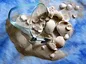 Can Cupping Improve COVID Vaccine Delivery?